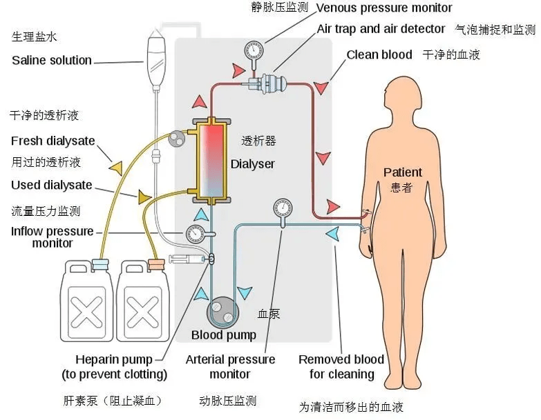 “革新人工肾脏技术前沿动态”